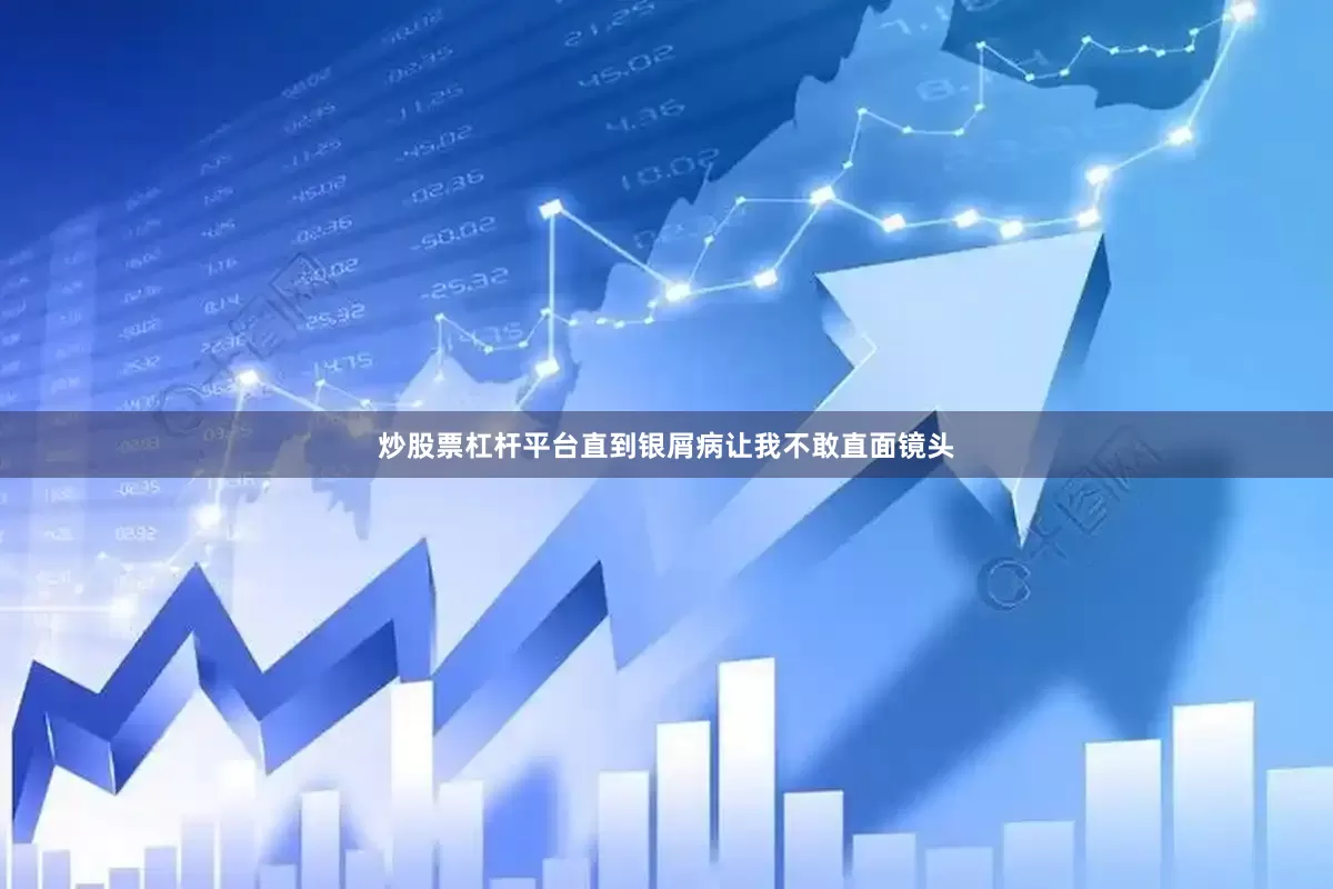 炒股票杠杆平台直到银屑病让我不敢直面镜头